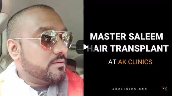 Celebrity Hair Transplant